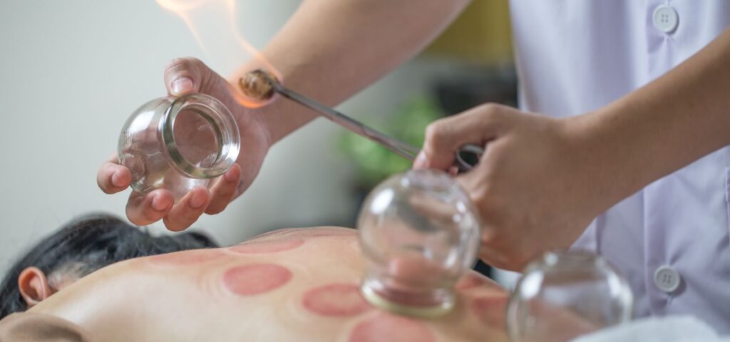 medicina tradicional xinesa terrassa