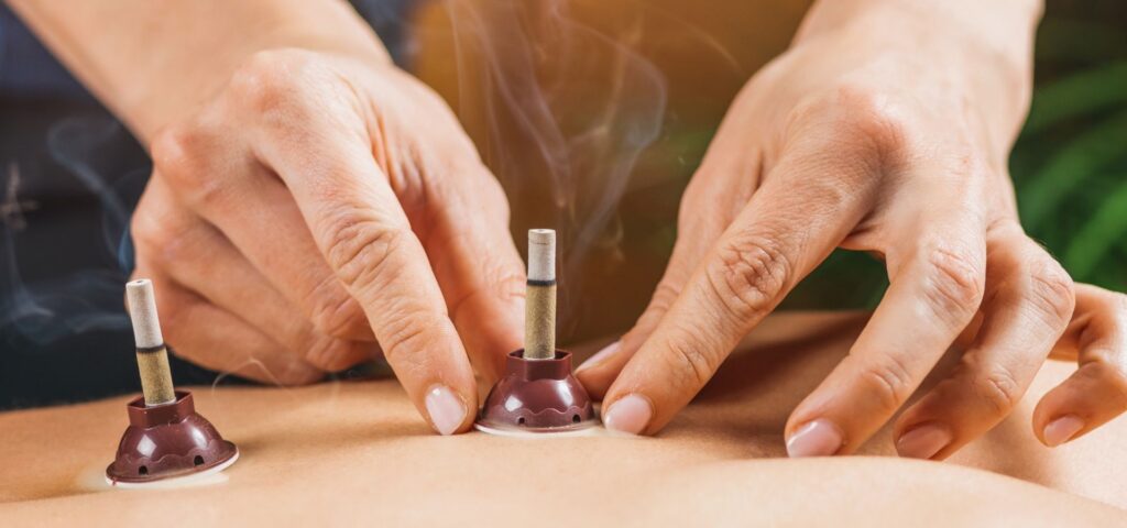 medicina tradicional xinesa a terrassa